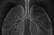The Air We Breathe