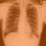 Cyberen's Bone Density