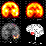 the Funny Epilepsy Game