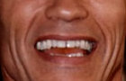 Arnold Story