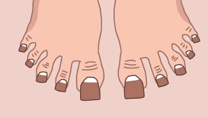 Toenail Blitz