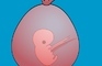 Abort A Fetus Balloons