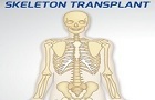 Skeleton Transplant