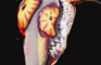 alfred's voncuulsion