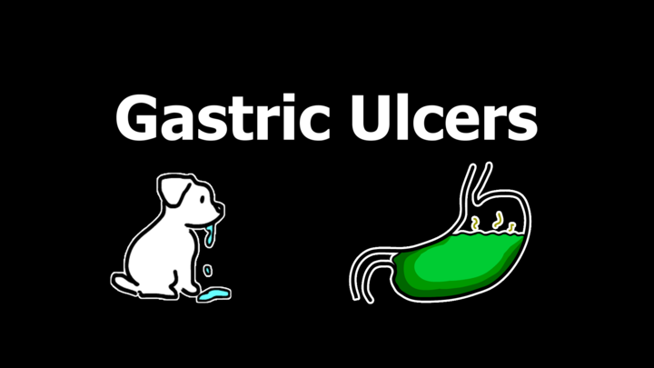 Gastric Ulcers (Apprise)