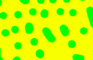 Seizure