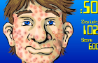 Acne Be Gone - the Game