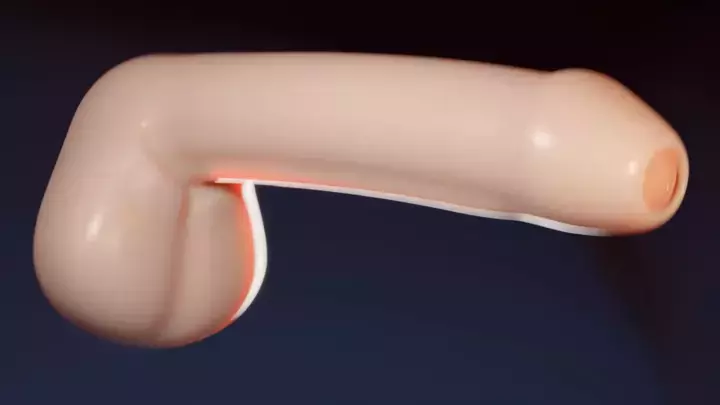 Dong Dong Yes Yes