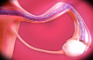 Tifa's unbelievable impregnation