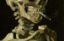 Skeletony