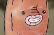 Eye Health