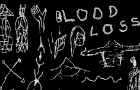Blood Loss